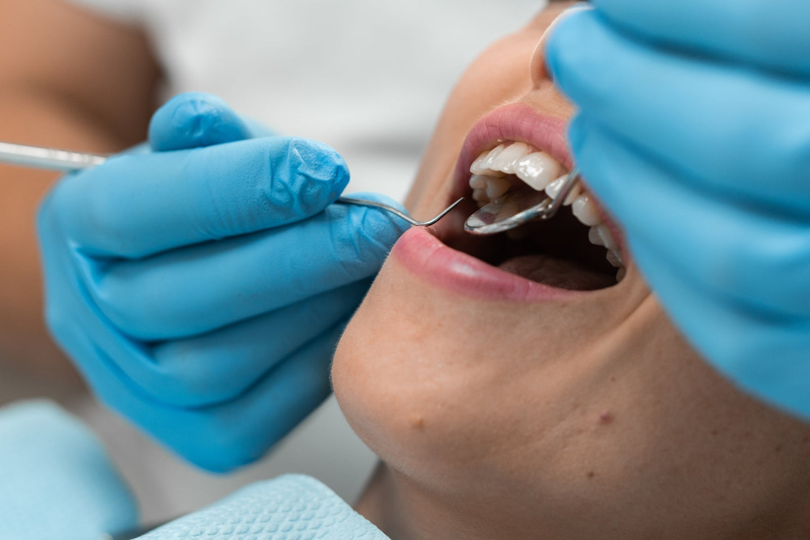 "Ozempic Mouth" Explained: Symptoms, Causes and What Helps